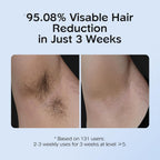 SmoothSkin Laser Hair Remover